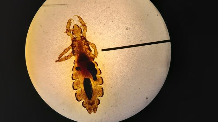 Vergrößerte Ansicht eines kleinen, transparenten, bernsteinfarbene Insekts unter einem Mikroskop. Es hat einen länglichen Körper mit mehreren Beinpaaren und Antennen. Der Hintergrund ist kreisförmig und hell beleuchtet, der äußere Bereich des Bildes dunkel ist.